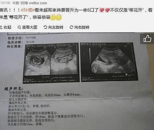  离婚后她转身收到六胎孕检单免费全集，离婚后她意外怀上六胞胎--第1张