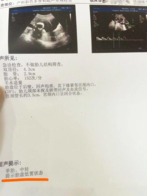 离婚后她转身收到六胎孕检单短剧  离婚后她转身收到六胎孕检单短剧，离婚后她转身收到六胎孕检单，婚姻的讽刺--第1张