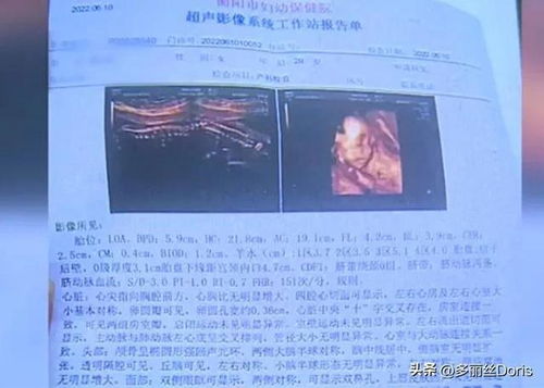 离婚后前夫捡到了我的孕检单短剧  离婚后前夫捡到了我的孕检单短剧，离婚后前夫捡到了我的孕检单，意外重逢的纠葛--第1张