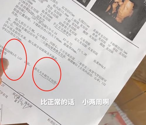 离婚后她转身收到六胎孕检单短剧资讯  离婚后她转身收到六胎孕检单短剧资讯--第1张