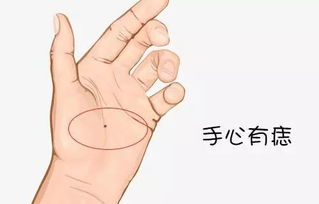 你是我的掌心痣短剧在线观看--第1张