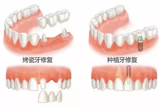 以牙还牙第5集，复仇的火焰--第1张