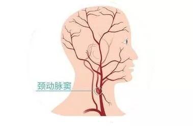 按摩后脑梗女子健康奇迹，22岁女子康复之路--第1张